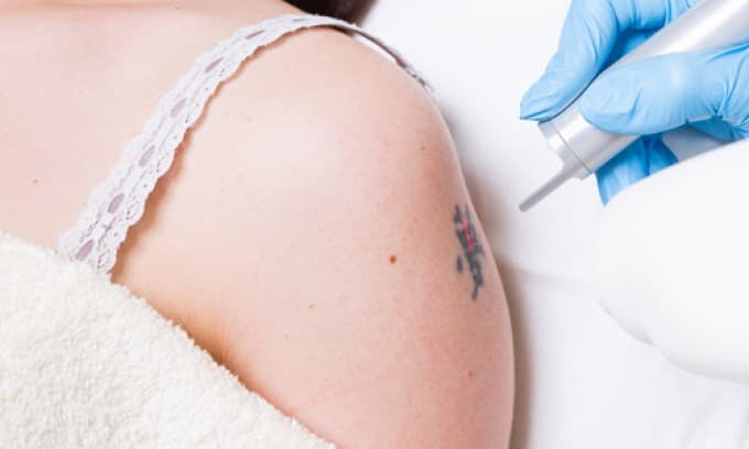 Özel Elos Lazer Polikliniği