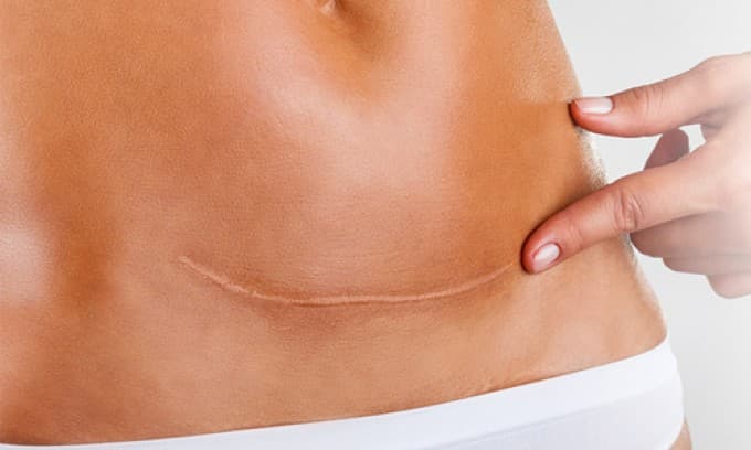 Özel Elos Lazer Polikliniği