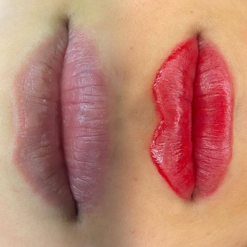 Sıla Zengin Güzellik Salonu - Eryaman Cilt Yenileme - 4. Fotoğraf