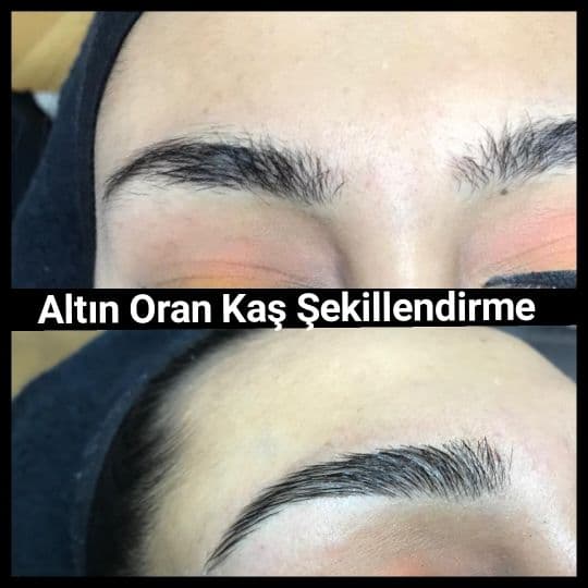 Yeliz Gazeloğlu Beauty Center - 13. Fotoğraf