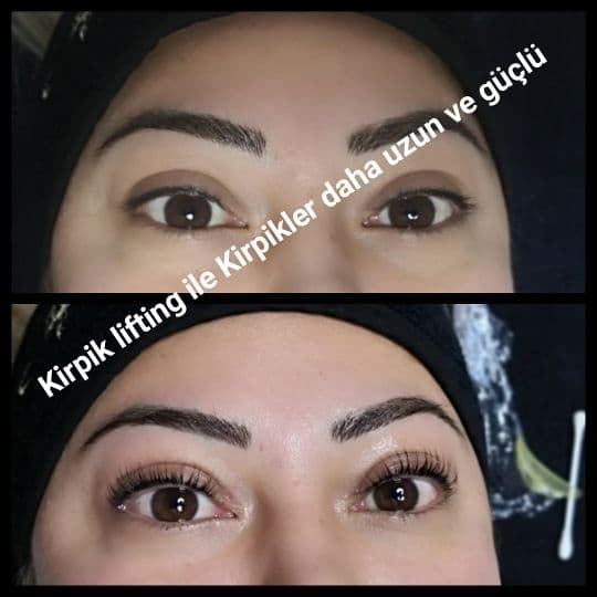 Yeliz Gazeloğlu Beauty Center - 6. Fotoğraf