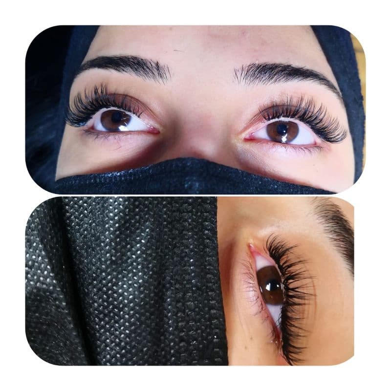 Yeliz Gazeloğlu Beauty Center - Dikmen  Cilt Yenileme - 2. Fotoğraf