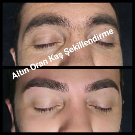 Yeliz Gazeloğlu Beauty Center - Dikmen  Cilt Yenileme - 3. Fotoğraf