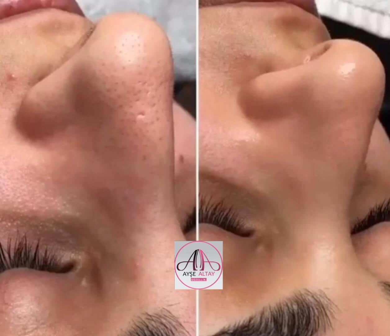 Ayşe Alya Güzellik Merkezi