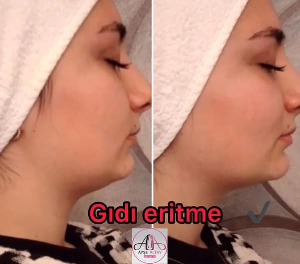Ayşe Altay Güzellik Merkezi - 80. Fotoğraf