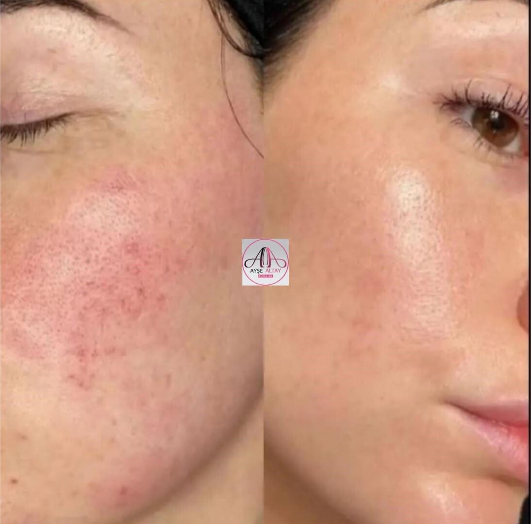 Ayşe Alya Güzellik Merkezi