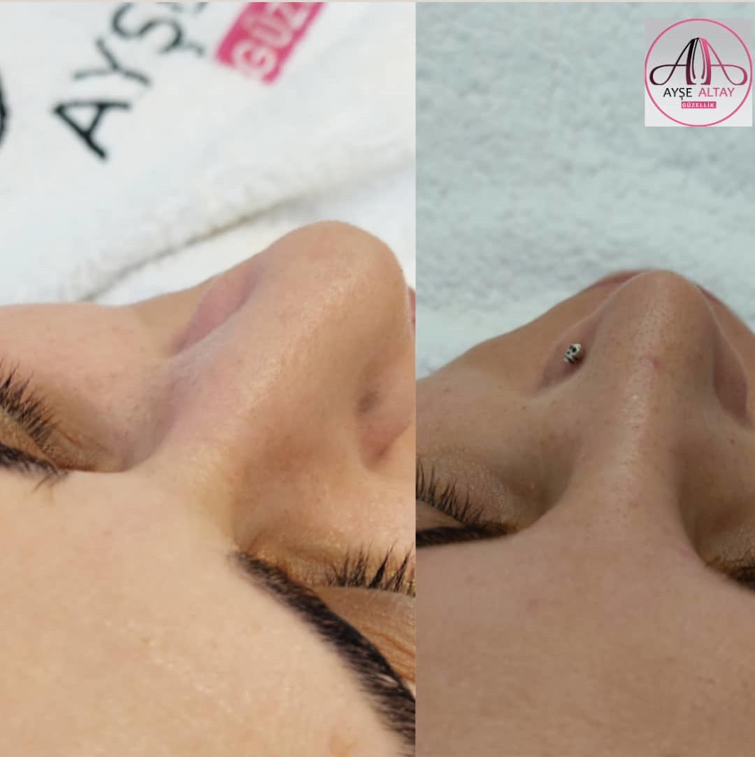 Ayşe Alya Güzellik Merkezi