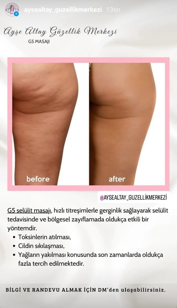 Ayşe Altay Güzellik Merkezi - 158. Fotoğraf
