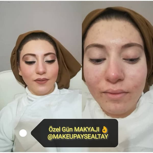 Ayşe Altay Güzellik Merkezi - 49. Fotoğraf