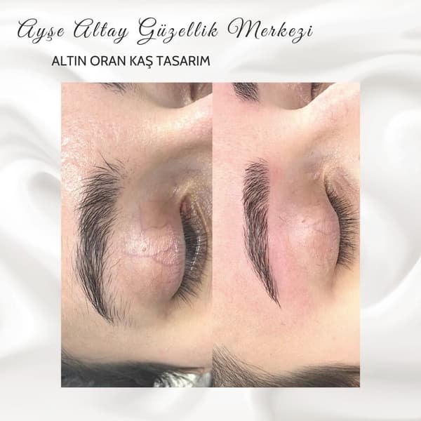 Ayşe Altay Güzellik Merkezi - 156. Fotoğraf
