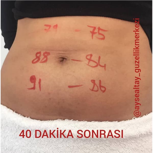 Ayşe Altay Güzellik Merkezi - 22. Fotoğraf