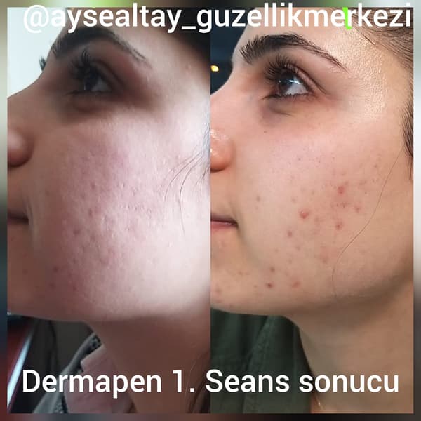 Ayşe Altay Güzellik Merkezi - 6. Fotoğraf