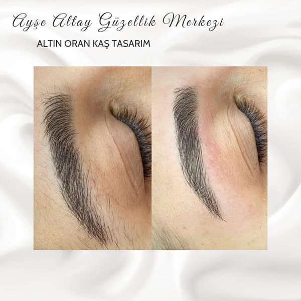 Ayşe Altay Güzellik Merkezi - 157. Fotoğraf