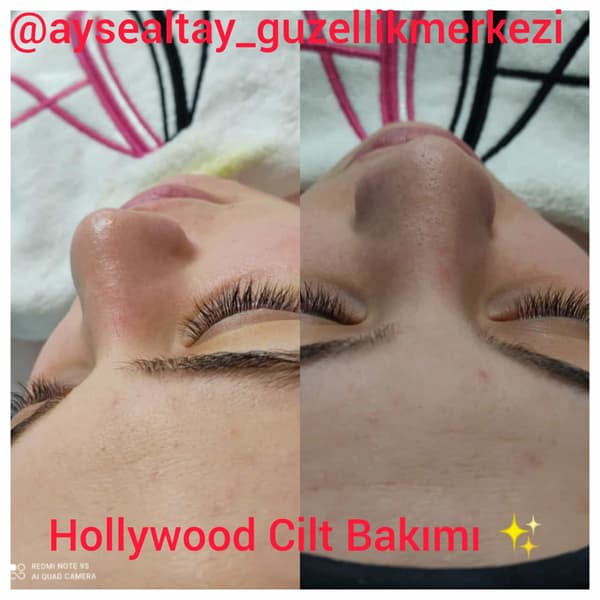 Ayşe Altay Güzellik Merkezi - 9. Fotoğraf