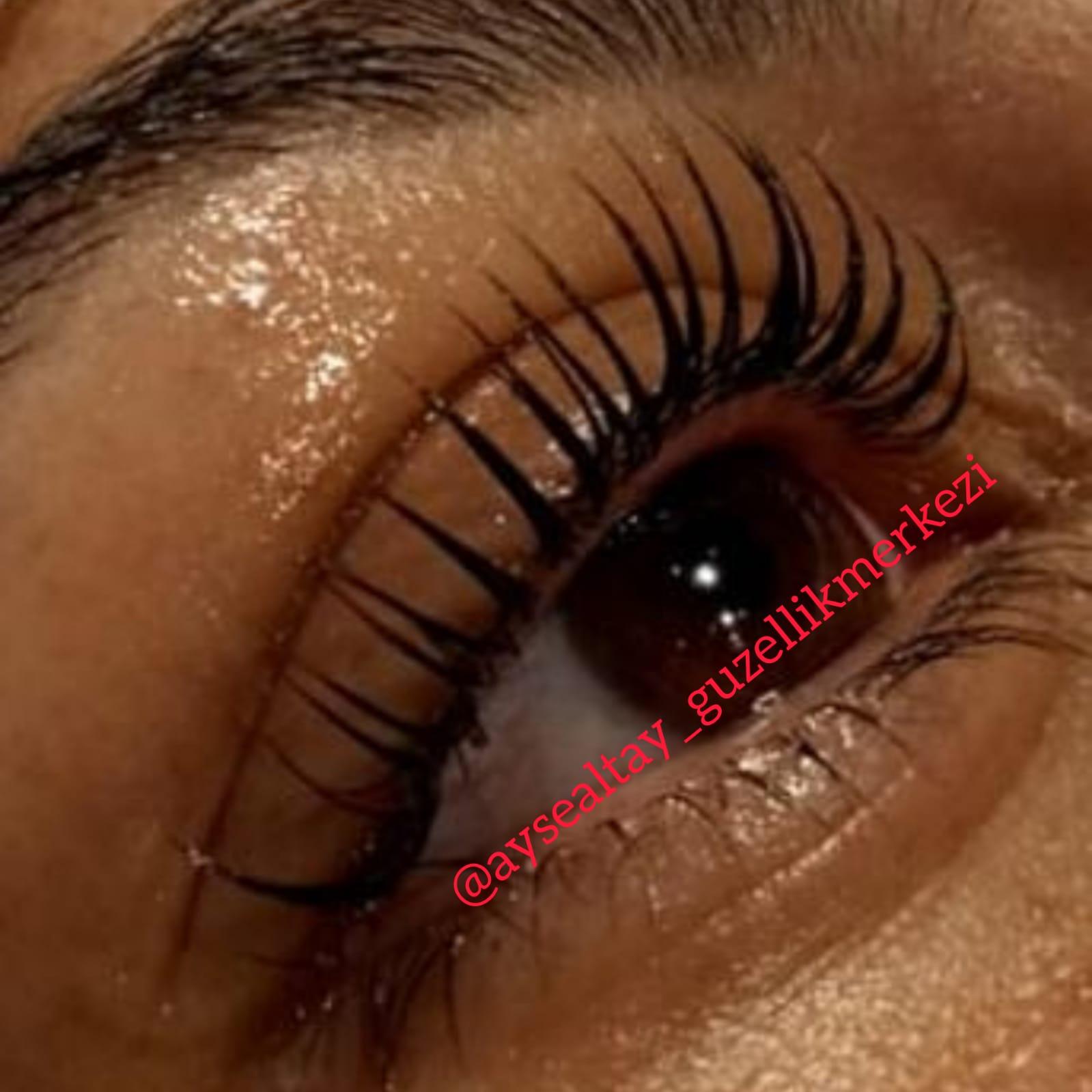 Ayşe Alya Güzellik Merkezi - Batıkent Cilt Yenileme - 4. Fotoğraf