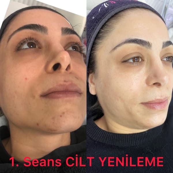 Ayşe Altay Güzellik Merkezi - 89. Fotoğraf