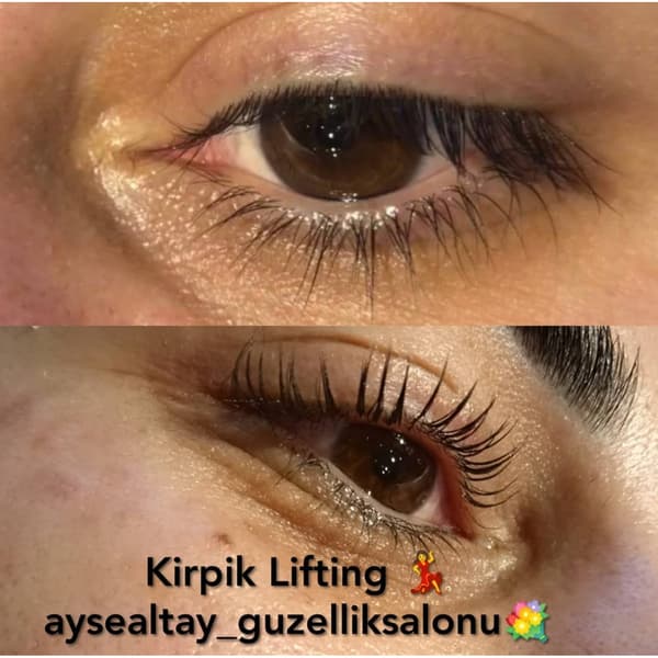 Ayşe Altay Güzellik Merkezi - 62. Fotoğraf