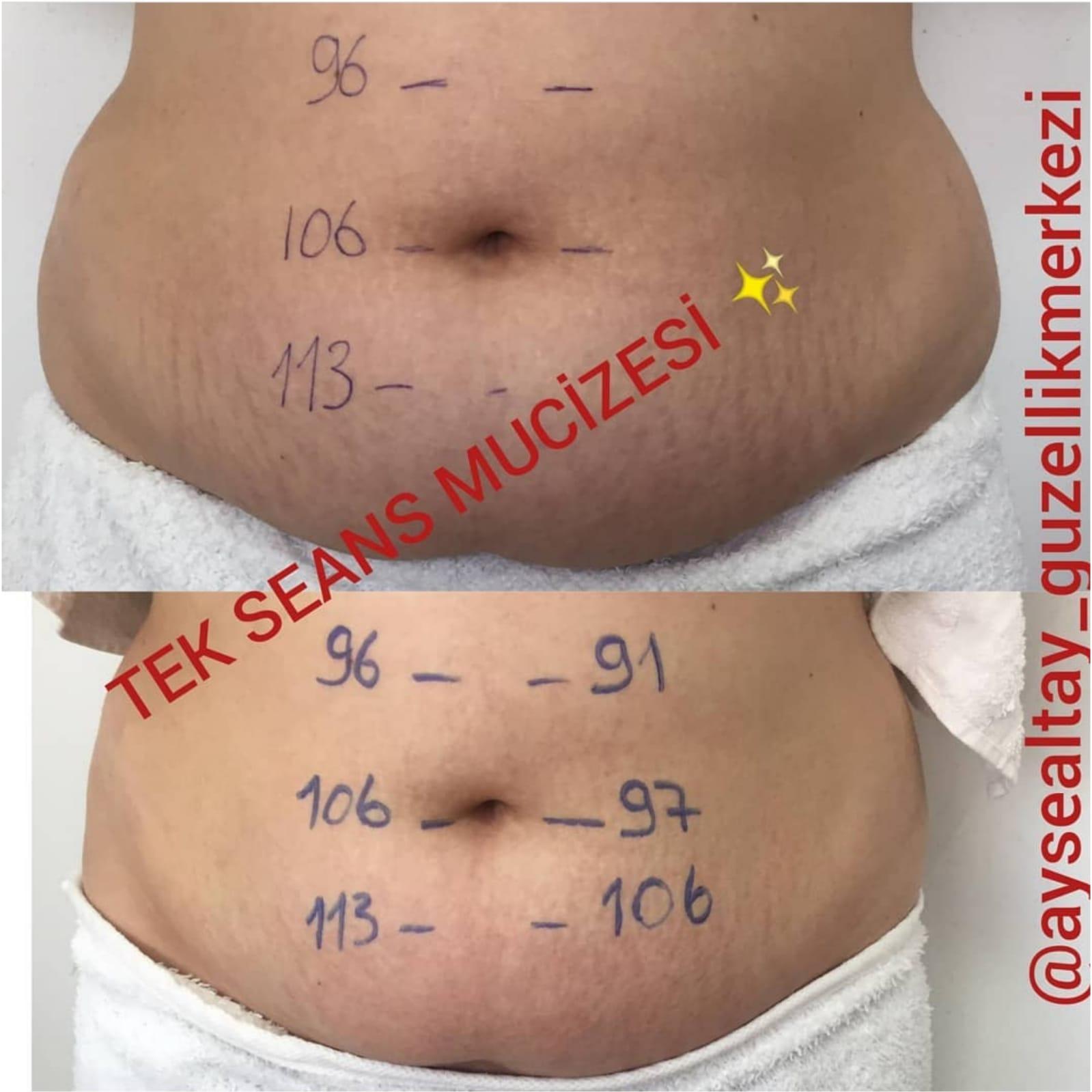 Ayşe Alya Güzellik Merkezi