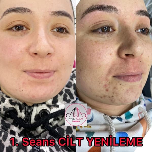 Ayşe Altay Güzellik Merkezi - 93. Fotoğraf