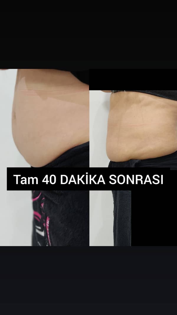 Ayşe Altay Güzellik Merkezi - 11. Fotoğraf