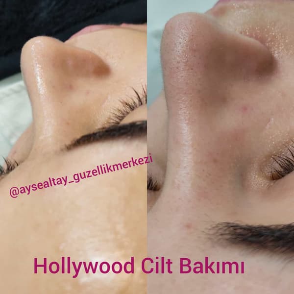 Ayşe Altay Güzellik Merkezi - 67. Fotoğraf