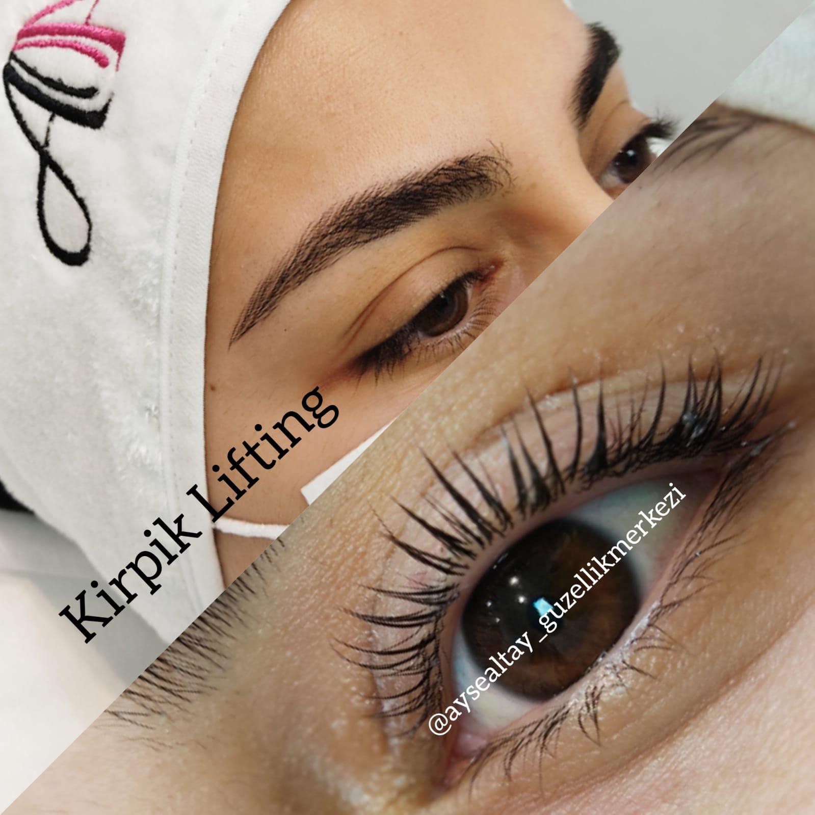 Ayşe Alya Güzellik Merkezi - Batıkent Cilt Yenileme - 2. Fotoğraf