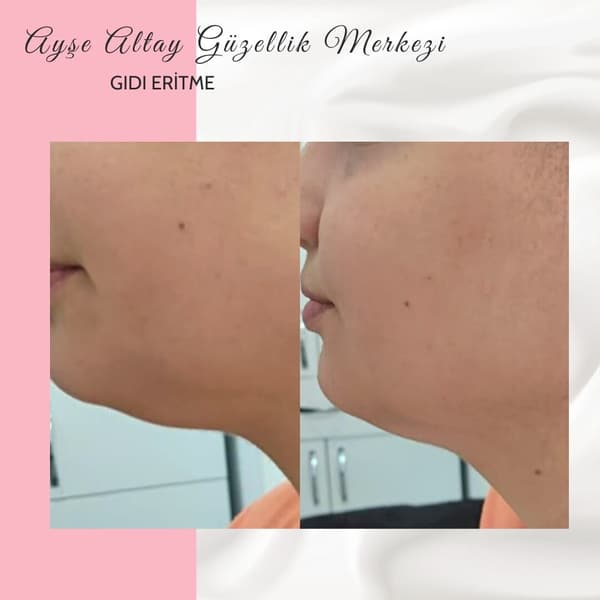 Ayşe Altay Güzellik Merkezi - 144. Fotoğraf