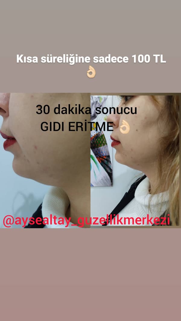 Ayşe Altay Güzellik Merkezi - 19. Fotoğraf