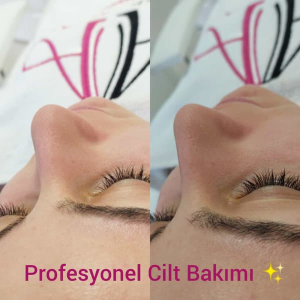 Ayşe Altay Güzellik Merkezi - 66. Fotoğraf