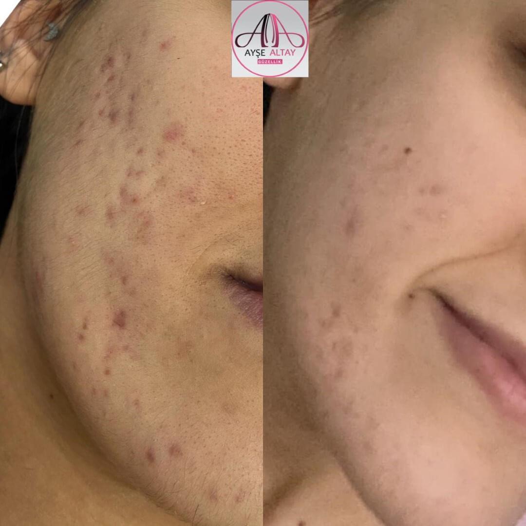 Ayşe Alya Güzellik Merkezi