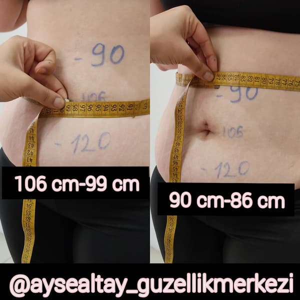 Ayşe Altay Güzellik Merkezi - 13. Fotoğraf