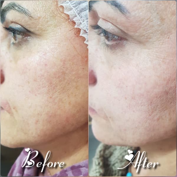 Nadire Güzellik Salonu - 33. Fotoğraf Nadire Güzellik Salonu - 33. Fotoğraf