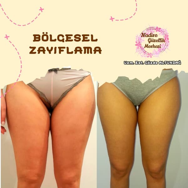 Nadire Güzellik Salonu - 65. Fotoğraf