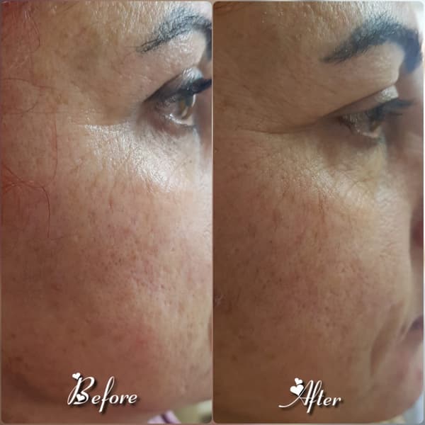 Nadire Güzellik Salonu - 32. Fotoğraf Nadire Güzellik Salonu - 32. Fotoğraf