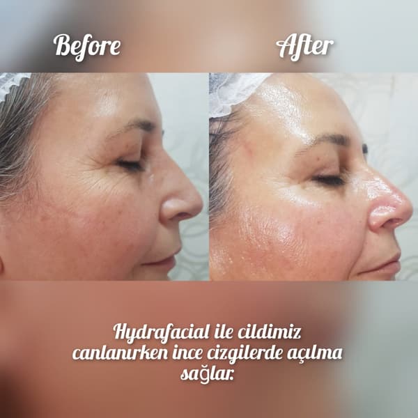 Nadire Güzellik Salonu - 19. Fotoğraf Nadire Güzellik Salonu - 19. Fotoğraf