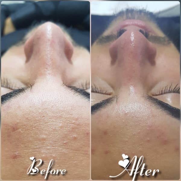 Nadire Güzellik Salonu - 39. Fotoğraf Nadire Güzellik Salonu - 39. Fotoğraf