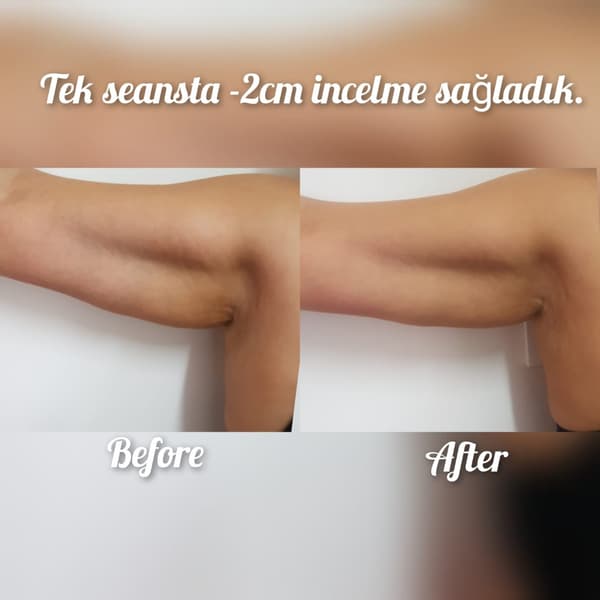 Nadire Güzellik Salonu - 17. Fotoğraf Nadire Güzellik Salonu - 17. Fotoğraf