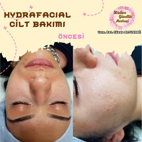 Nadire Güzellik Salonu - 66. Fotoğraf Nadire Güzellik Salonu - 66. Fotoğraf