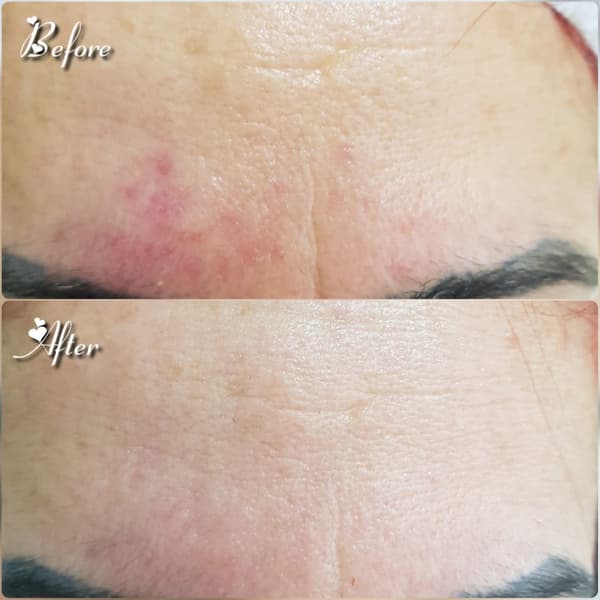 Nadire Güzellik Salonu - 35. Fotoğraf Nadire Güzellik Salonu - 35. Fotoğraf