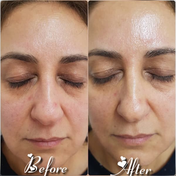 Nadire Güzellik Salonu - 30. Fotoğraf Nadire Güzellik Salonu - 30. Fotoğraf