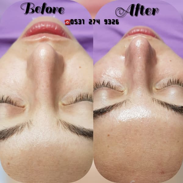 Nadire Güzellik Salonu - 21. Fotoğraf Nadire Güzellik Salonu - 21. Fotoğraf