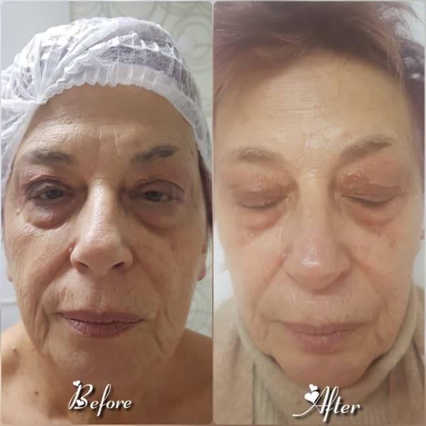 Nadire Güzellik Salonu - 26. Fotoğraf