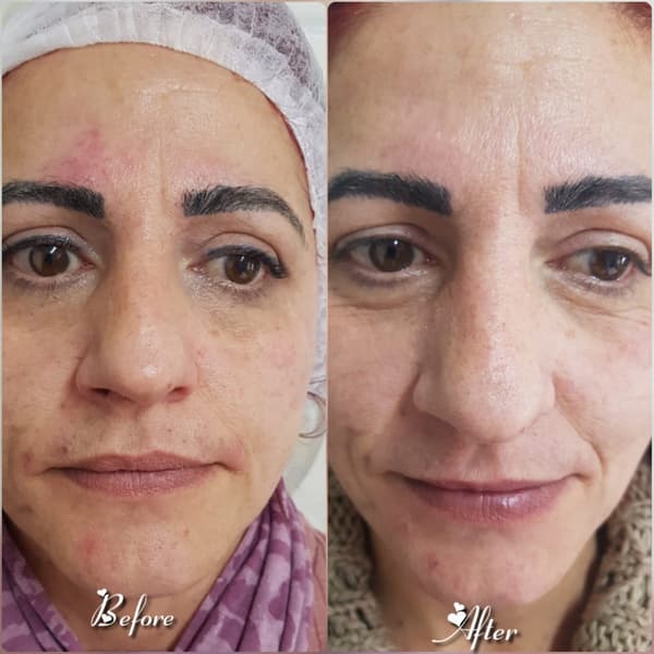 Nadire Güzellik Salonu - 28. Fotoğraf