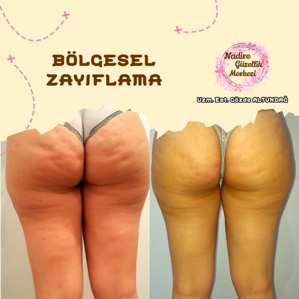 Nadire Güzellik Salonu - 67. Fotoğraf