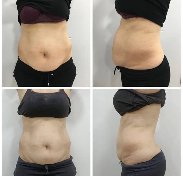 Nadire Güzellik Salonu - 53. Fotoğraf Nadire Güzellik Salonu - 53. Fotoğraf