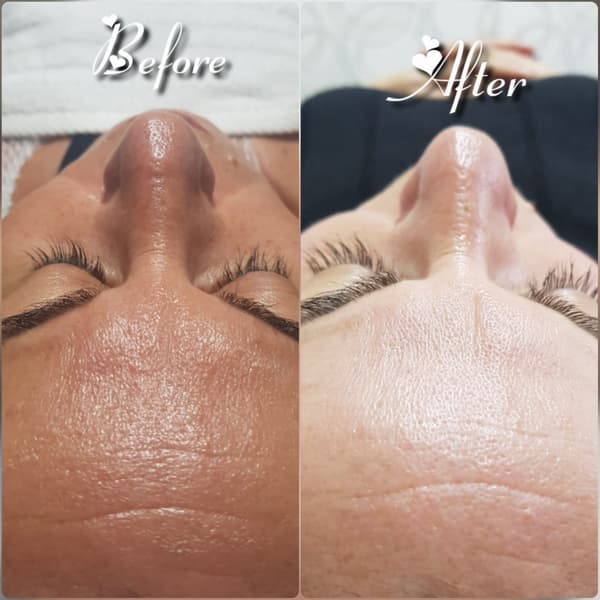 Nadire Güzellik Salonu - 20. Fotoğraf Nadire Güzellik Salonu - 20. Fotoğraf