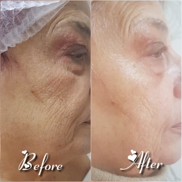 Nadire Güzellik Salonu - 24. Fotoğraf Nadire Güzellik Salonu - 24. Fotoğraf