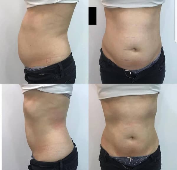 Nadire Güzellik Salonu - 54. Fotoğraf Nadire Güzellik Salonu - 54. Fotoğraf