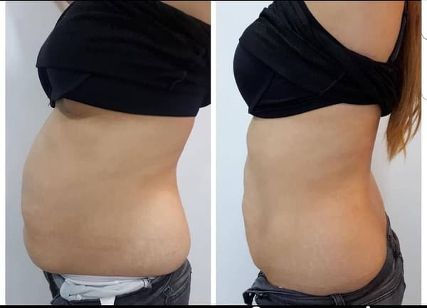 Nadire Güzellik Salonu - 56. Fotoğraf Nadire Güzellik Salonu - 56. Fotoğraf