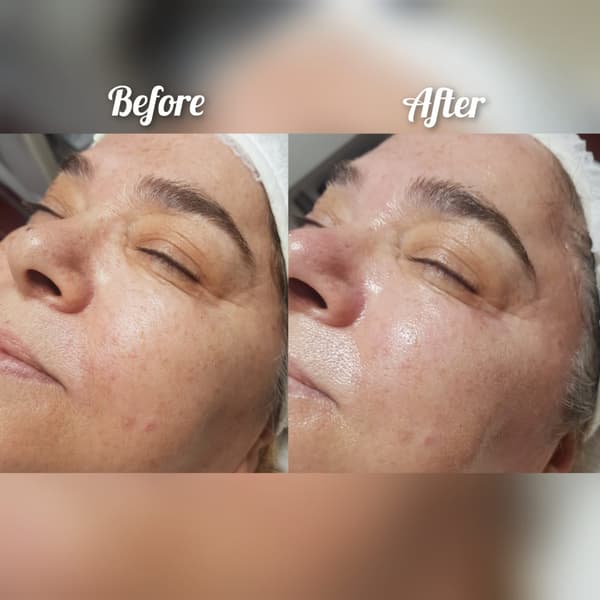 Nadire Güzellik Salonu - 18. Fotoğraf Nadire Güzellik Salonu - 18. Fotoğraf